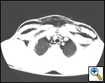 Figure 2a