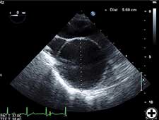 View Figure 2B larger