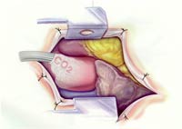 [Illustration:  Figure 2]