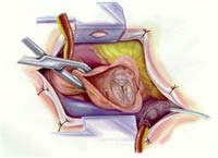 [Illustration:  Figure 4]