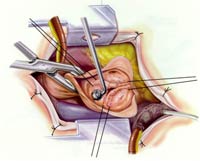 [Illustration:  Figure 5]