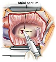 [Illustration:  Figure 5a]