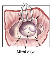 [Illustration:  Figure 5b]