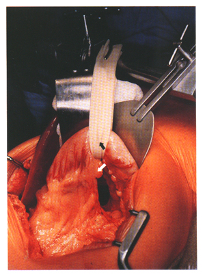 [Illustration:  Figure 2]