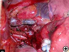 View Figure 11B larger