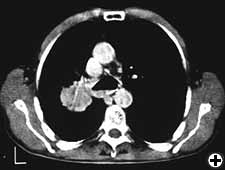 View Figure 1A larger