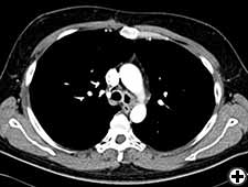 View Figure 1B larger