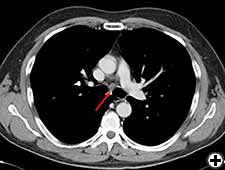 View Figure 1C larger