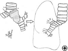 View Figure 2B larger