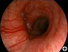 View Figure 3B larger