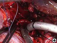 View Figure 5B larger