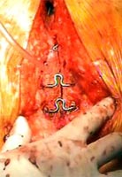 Video Frame