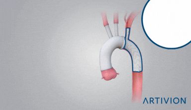 Artivion - Artizen Artivion - Artizen