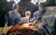 Minimally Invasive Mitral Valve Repair